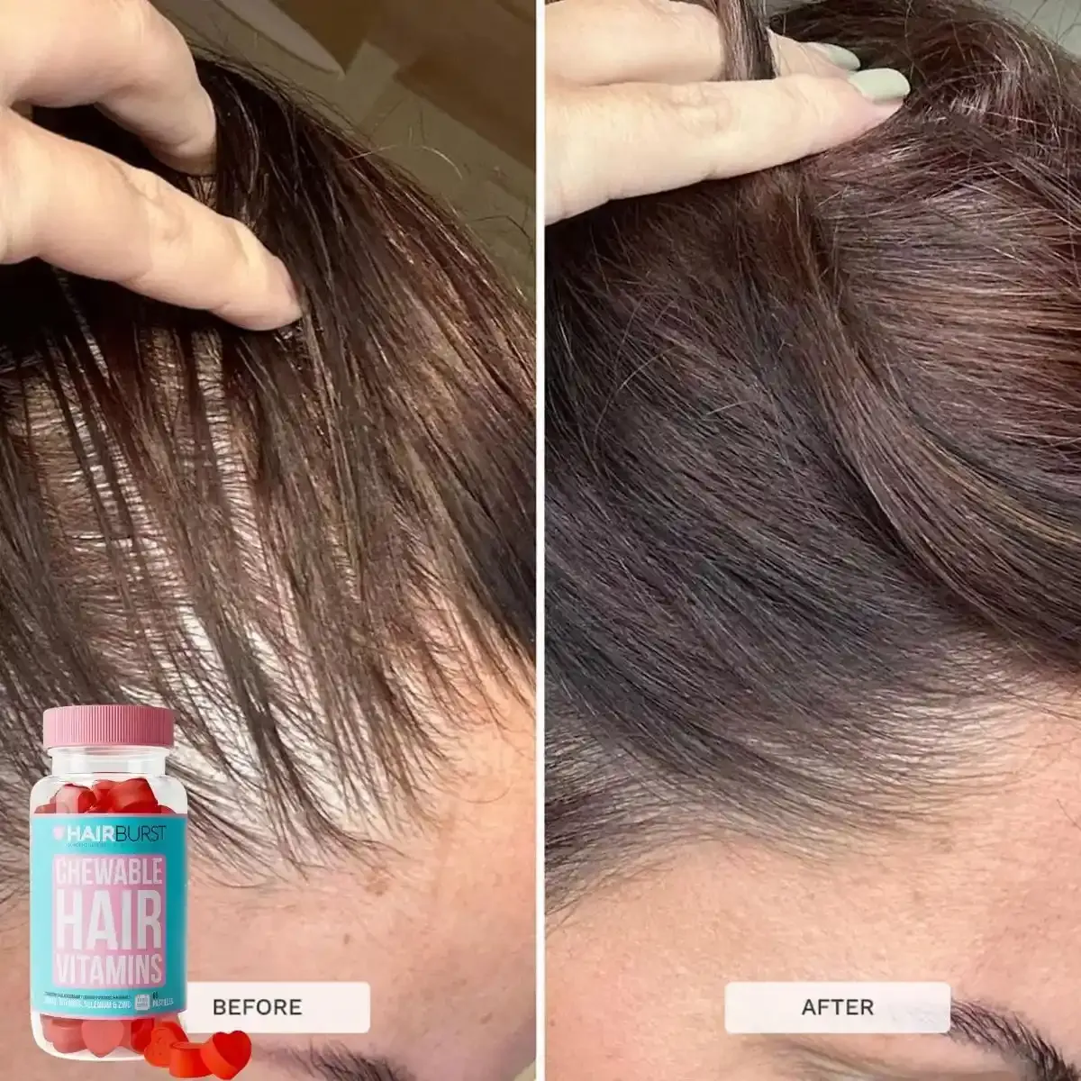 Chewable-Hair-Vitamins-5