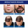 محلول رشد مجدد مو ماینوکسیدیل ۵% کرکلند مردانه | Kirkland Signature Minoxidil 5% Topical Solution for Men - 10