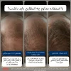 محلول رشد مجدد مو ماینوکسیدیل ۵% کرکلند مردانه | Kirkland Signature Minoxidil 5% Topical Solution for Men - 7