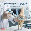 خرید آمپول مونویسک (مونو ویسک) کاهش درد آرتروز و بهبود حرکت مفصل | Monovisc 88 mg/4 mL - 2